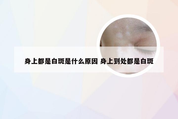 身上都是白斑是什么原因 身上到处都是白斑