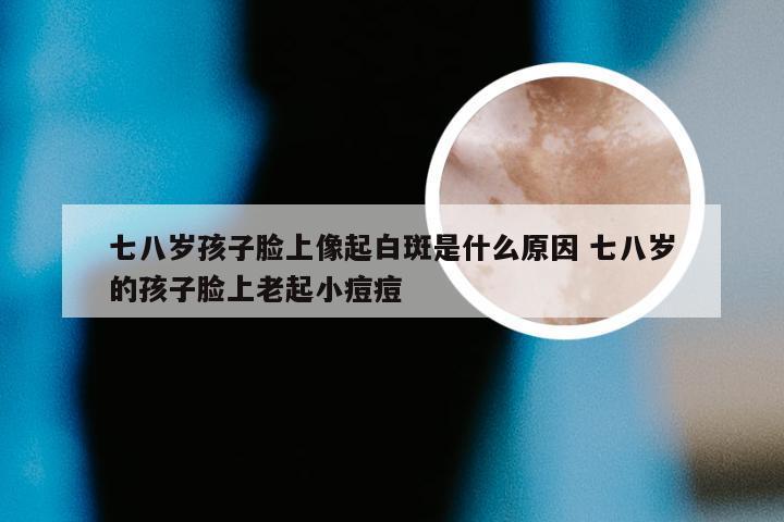 七八岁孩子脸上像起白斑是什么原因 七八岁的孩子脸上老起小痘痘