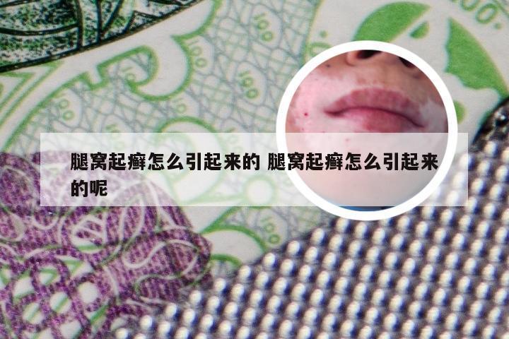 腿窝起癣怎么引起来的 腿窝起癣怎么引起来的呢