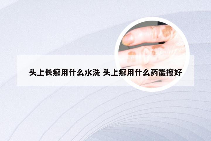 头上长癣用什么水洗 头上癣用什么药能擦好