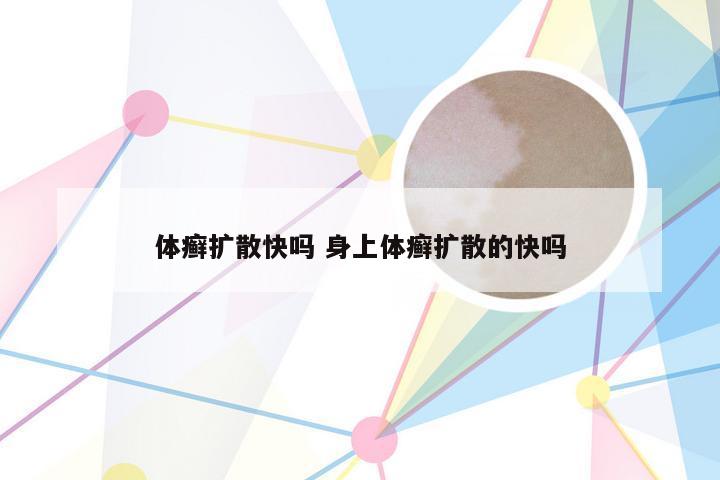 体癣扩散快吗 身上体癣扩散的快吗