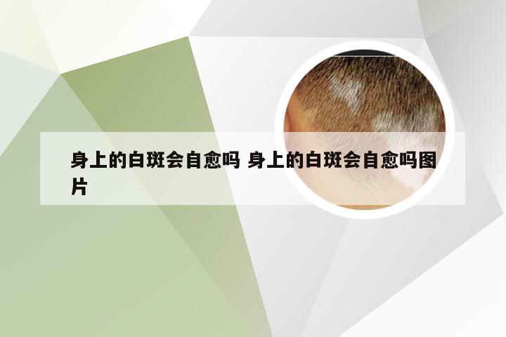 身上的白斑会自愈吗 身上的白斑会自愈吗图片