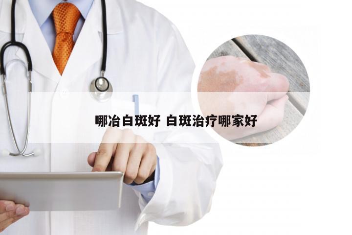 哪冶白斑好 白斑治疗哪家好