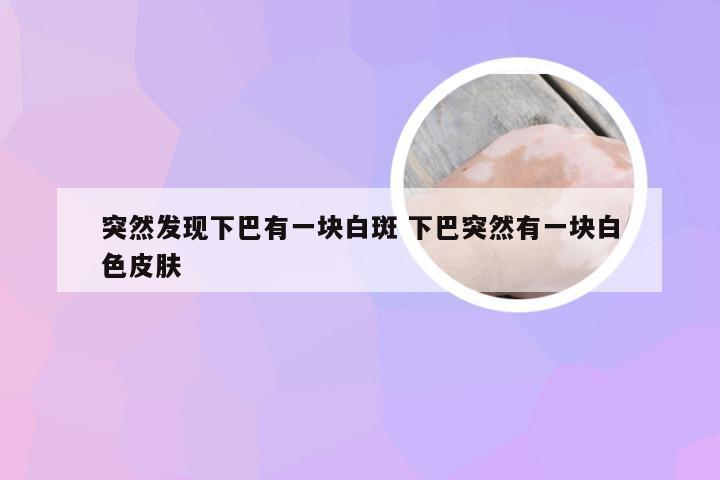 突然发现下巴有一块白斑 下巴突然有一块白色皮肤