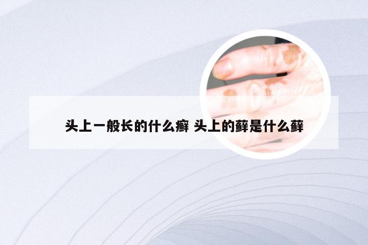 头上一般长的什么癣 头上的藓是什么藓