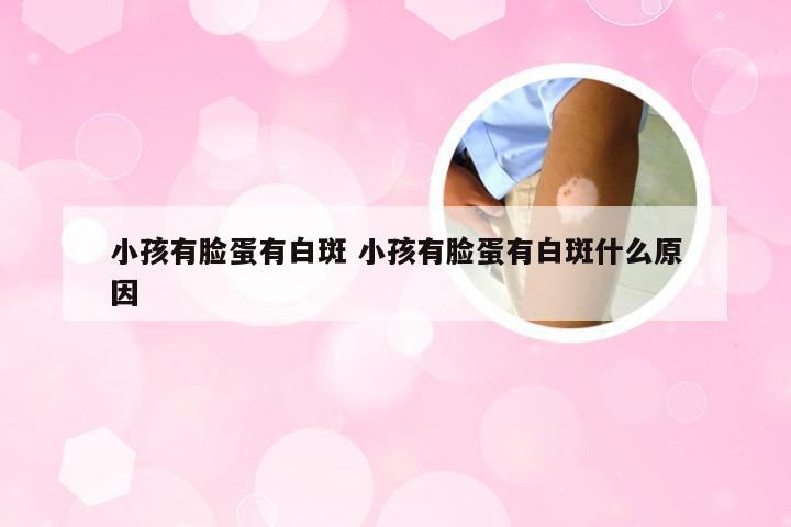 小孩有脸蛋有白斑 小孩有脸蛋有白斑什么原因