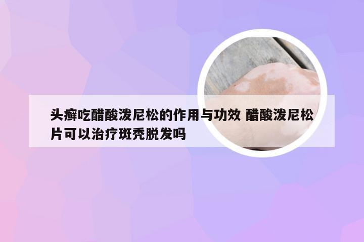 头癣吃醋酸泼尼松的作用与功效 醋酸泼尼松片可以治疗斑秃脱发吗