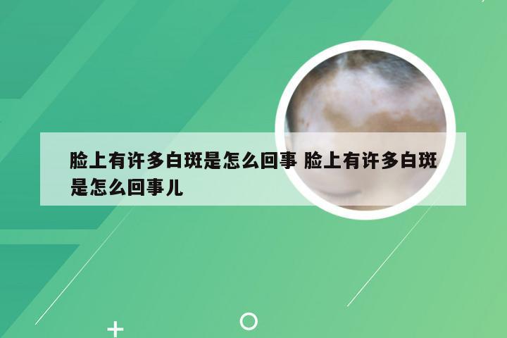 脸上有许多白斑是怎么回事 脸上有许多白斑是怎么回事儿