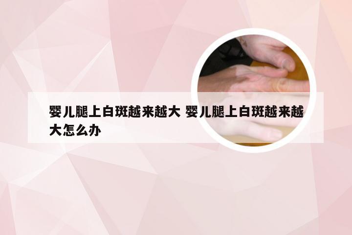 婴儿腿上白斑越来越大 婴儿腿上白斑越来越大怎么办