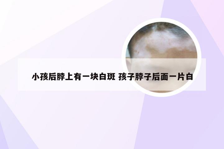 小孩后脖上有一块白斑 孩子脖子后面一片白