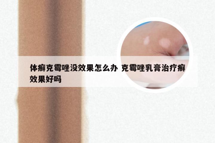 体癣克霉唑没效果怎么办 克霉唑乳膏治疗癣效果好吗