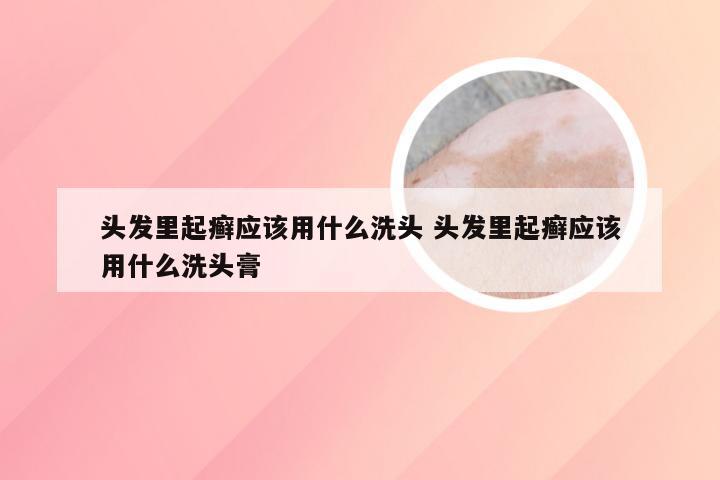 头发里起癣应该用什么洗头 头发里起癣应该用什么洗头膏