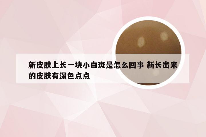 新皮肤上长一块小白斑是怎么回事 新长出来的皮肤有深色点点