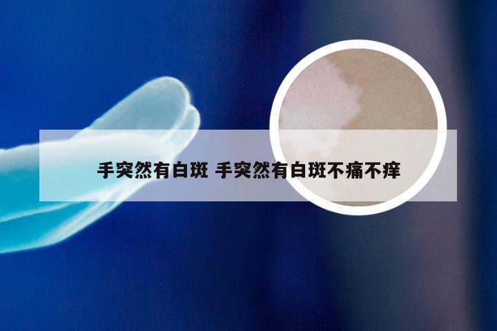 手突然有白斑 手突然有白斑不痛不痒