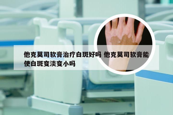 他克莫司软膏治疗白斑好吗 他克莫司软膏能使白斑变淡变小吗