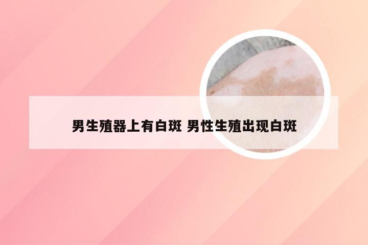 男生殖器上有白斑 男性生殖出现白斑