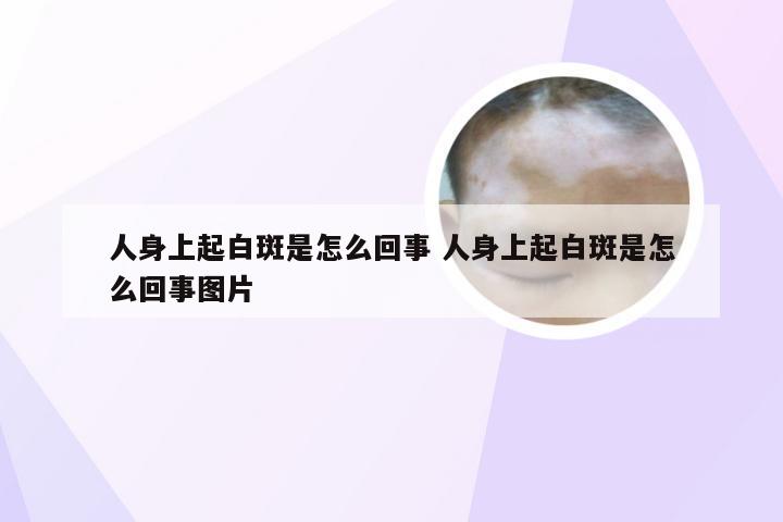 人身上起白斑是怎么回事 人身上起白斑是怎么回事图片