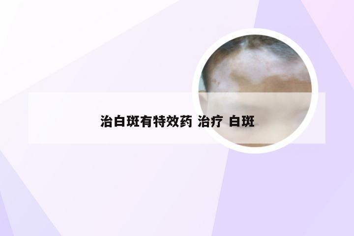 治白斑有特效药 治疗 白斑