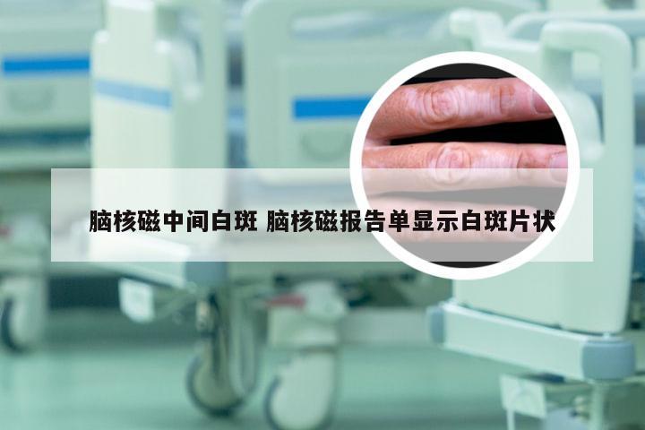 脑核磁中间白斑 脑核磁报告单显示白斑片状