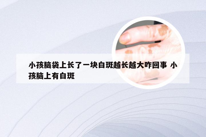 小孩脑袋上长了一块白斑越长越大咋回事 小孩脑上有白斑