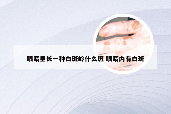 眼睛里长一种白斑岭什么斑 眼睛内有白斑