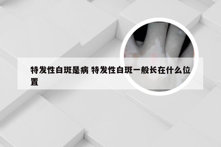 特发性白斑是病 特发性白斑一般长在什么位置