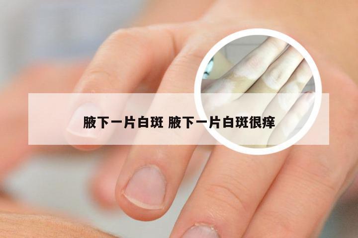 腋下一片白斑 腋下一片白斑很痒