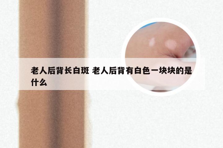 老人后背长白斑 老人后背有白色一块块的是什么