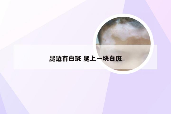 腿边有白斑 腿上一块白斑