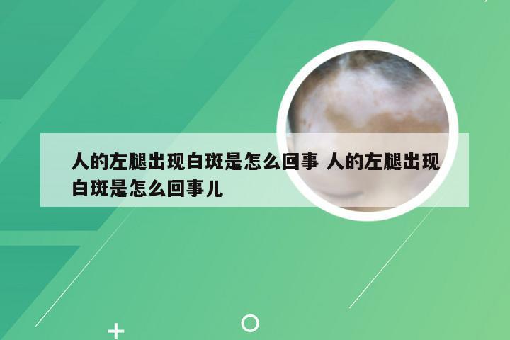 人的左腿出现白斑是怎么回事 人的左腿出现白斑是怎么回事儿