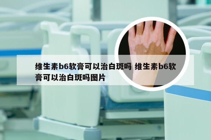 维生素b6软膏可以治白斑吗 维生素b6软膏可以治白斑吗图片