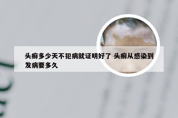 头癣多少天不犯病就证明好了 头癣从感染到发病要多久