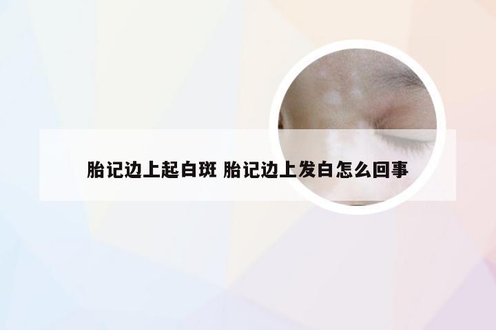 胎记边上起白斑 胎记边上发白怎么回事