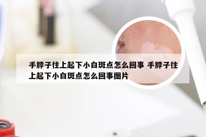 手脖子往上起下小白斑点怎么回事 手脖子往上起下小白斑点怎么回事图片