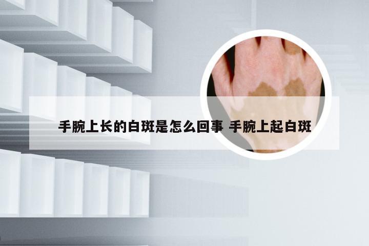 手腕上长的白斑是怎么回事 手腕上起白斑