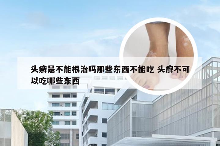 头癣是不能根治吗那些东西不能吃 头癣不可以吃哪些东西