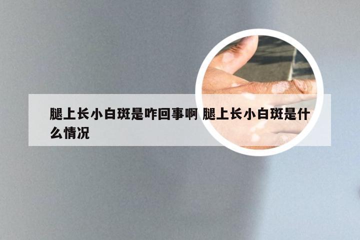 腿上长小白斑是咋回事啊 腿上长小白斑是什么情况