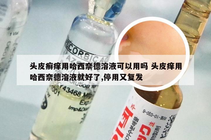 头皮癣痒用哈西奈德溶液可以用吗 头皮痒用哈西奈德溶液就好了,停用又复发