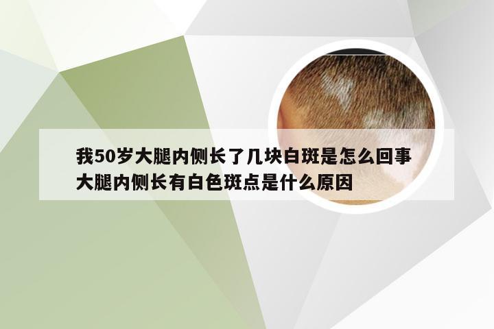 我50岁大腿内侧长了几块白斑是怎么回事 大腿内侧长有白色斑点是什么原因