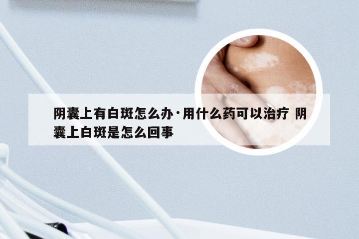 阴囊上有白斑怎么办·用什么药可以治疗 阴囊上白斑是怎么回事