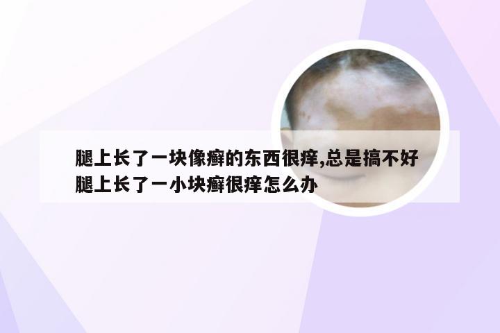 腿上长了一块像癣的东西很痒,总是搞不好 腿上长了一小块癣很痒怎么办