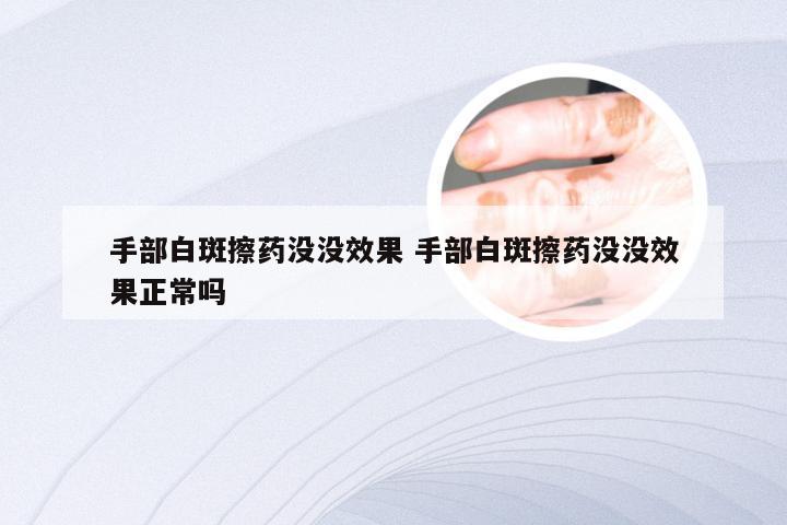 手部白斑擦药没没效果 手部白斑擦药没没效果正常吗