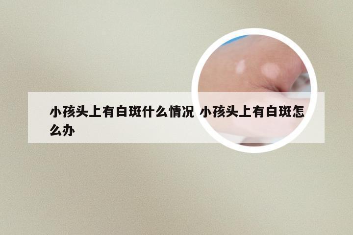 小孩头上有白斑什么情况 小孩头上有白斑怎么办