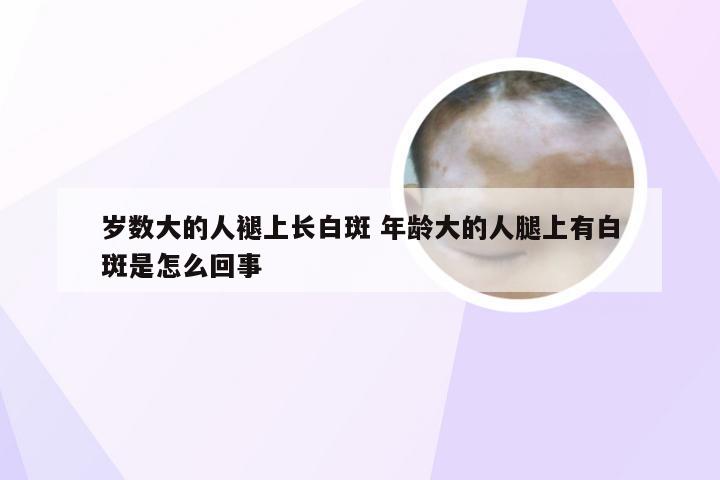 岁数大的人褪上长白斑 年龄大的人腿上有白斑是怎么回事