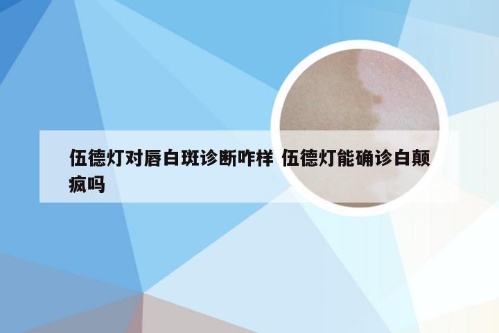 伍德灯对唇白斑诊断咋样 伍德灯能确诊白颠疯吗