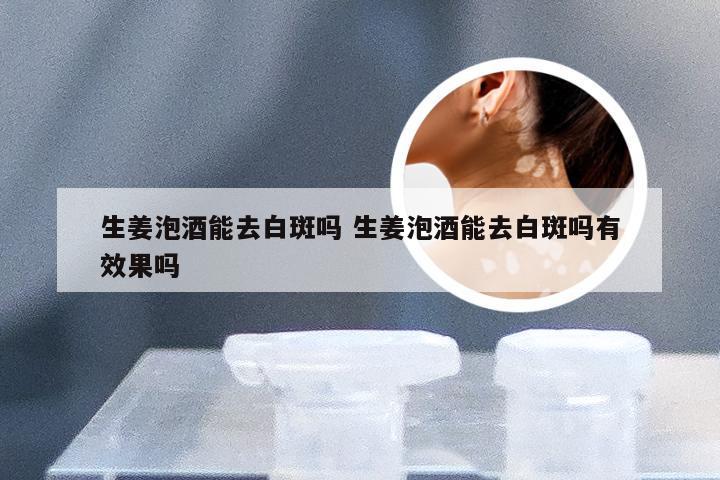 生姜泡酒能去白斑吗 生姜泡酒能去白斑吗有效果吗