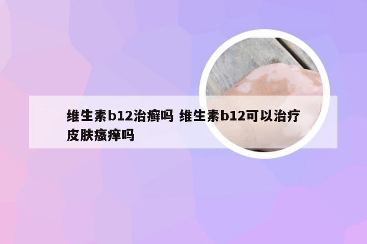 维生素b12治癣吗 维生素b12可以治疗皮肤瘙痒吗