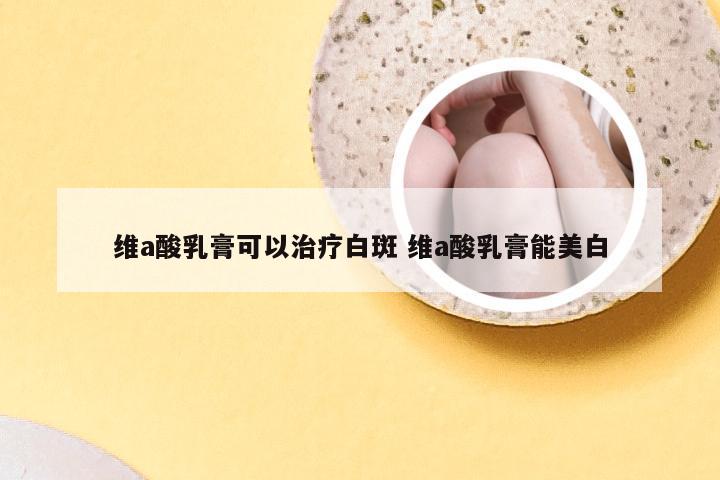 维a酸乳膏可以治疗白斑 维a酸乳膏能美白