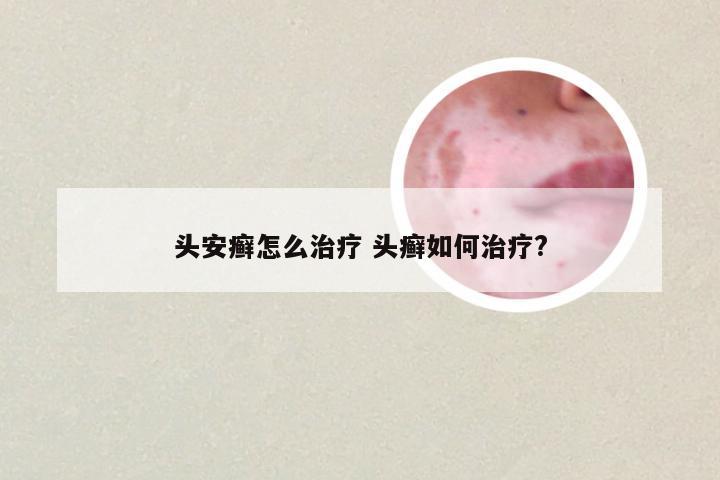 头安癣怎么治疗 头癣如何治疗?