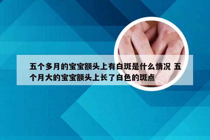 五个多月的宝宝额头上有白斑是什么情况 五个月大的宝宝额头上长了白色的斑点